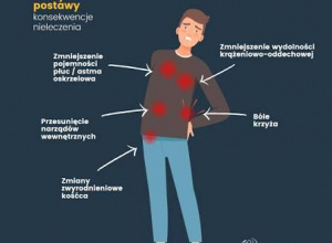 Wady postawy u dzieci.